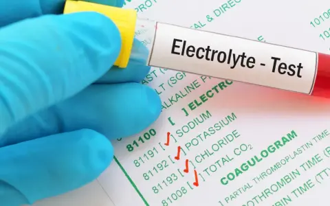 Ręka w niebieskiej rękawiczce trzyma probówkę z oznaczeniem "Electrolyte - Test" nad formularzem z badaniami, w tym jonogramem.