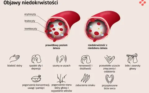 Prawidłowy poziom żelaza w naczyniu krwionośnym vs. niedobór żelaza. Objawy anemii: bladość, zmęczenie, szumy w uszach, bóle głowy.