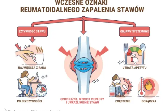 Wczesne objawy zapalenia stawów: sztywność, ból po bezczynności, opuchlizna, utrata apetytu, zmęczenie, gorączka.