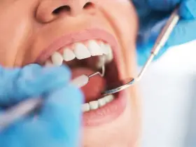 Dentysta wykonuje sanację jamy ustnej, używając lusterka i szczoteczki do czyszczenia zębów.